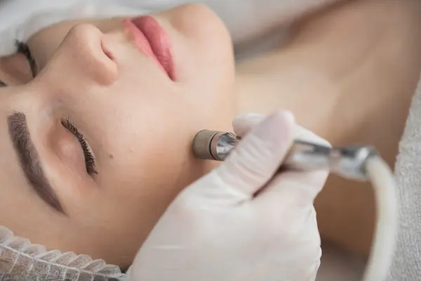 Dermabrasion