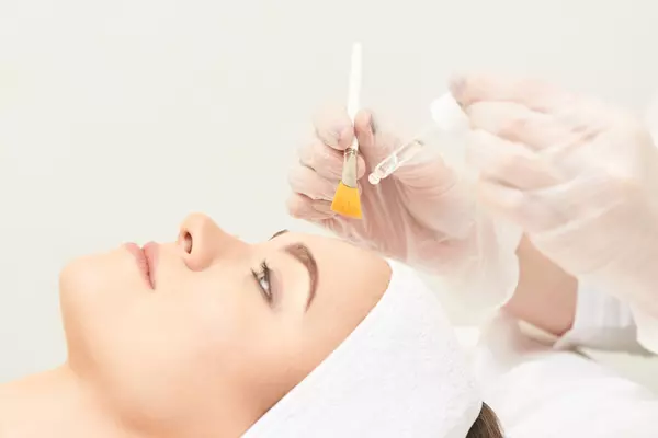 Fruchtsäurepeelings