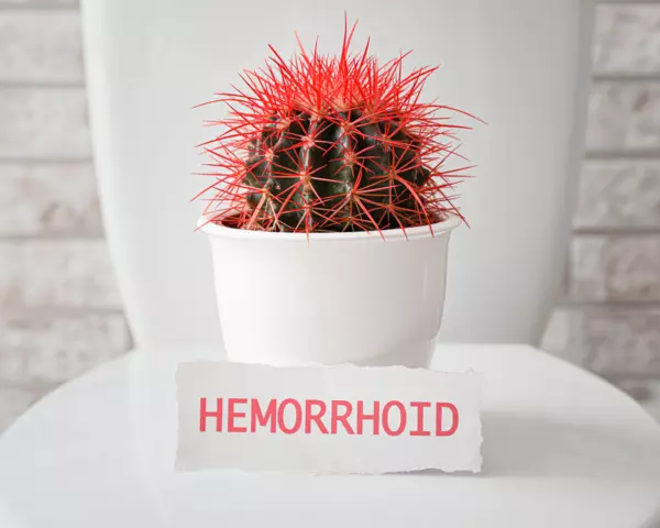 Hämorrhoiden