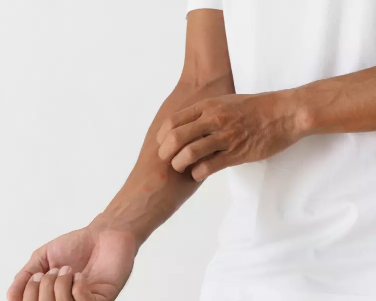 Wenn Ihre Haut den Sommer nicht erträgt