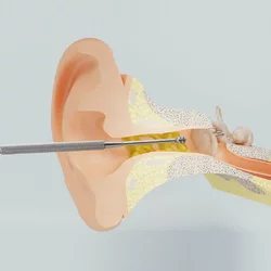 ReUseMe Ohr Reinigungs Tool