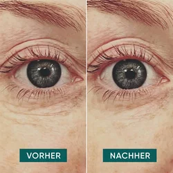 Apricot wiederverwendbare Anti-Falten-Augen Pads mit Hyaluron