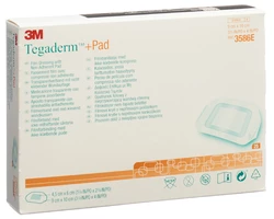 3M Tegaderm 9x10cm Wundkissen 4.5x6cm