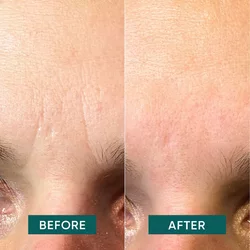 Apricot Gesichtspatches Niacinamide it's a skin-vestment