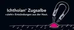 Ichtholan Zugsalbe 50 %