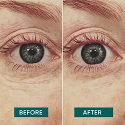 Apricot Augen Pad wiederverwendbar Hyaluron