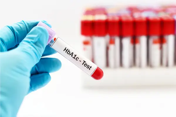 Hémoglobine