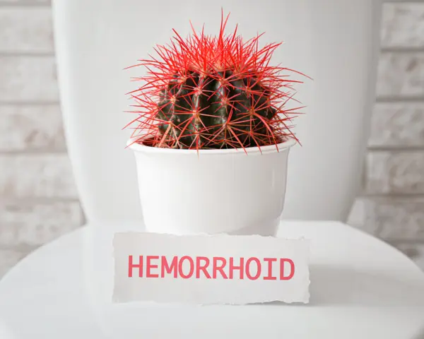 Emorroidi
