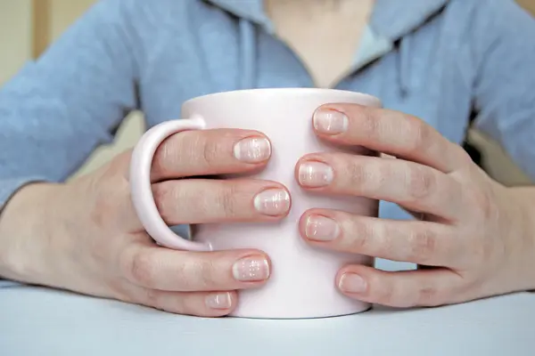 Nagelverfärbung